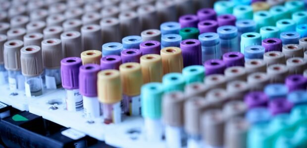 STDCheck – blood sample tubes in a lab